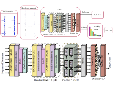 Deep Multi-instance Networks for Bundle Branch Block Detection from Multi-lead ECG